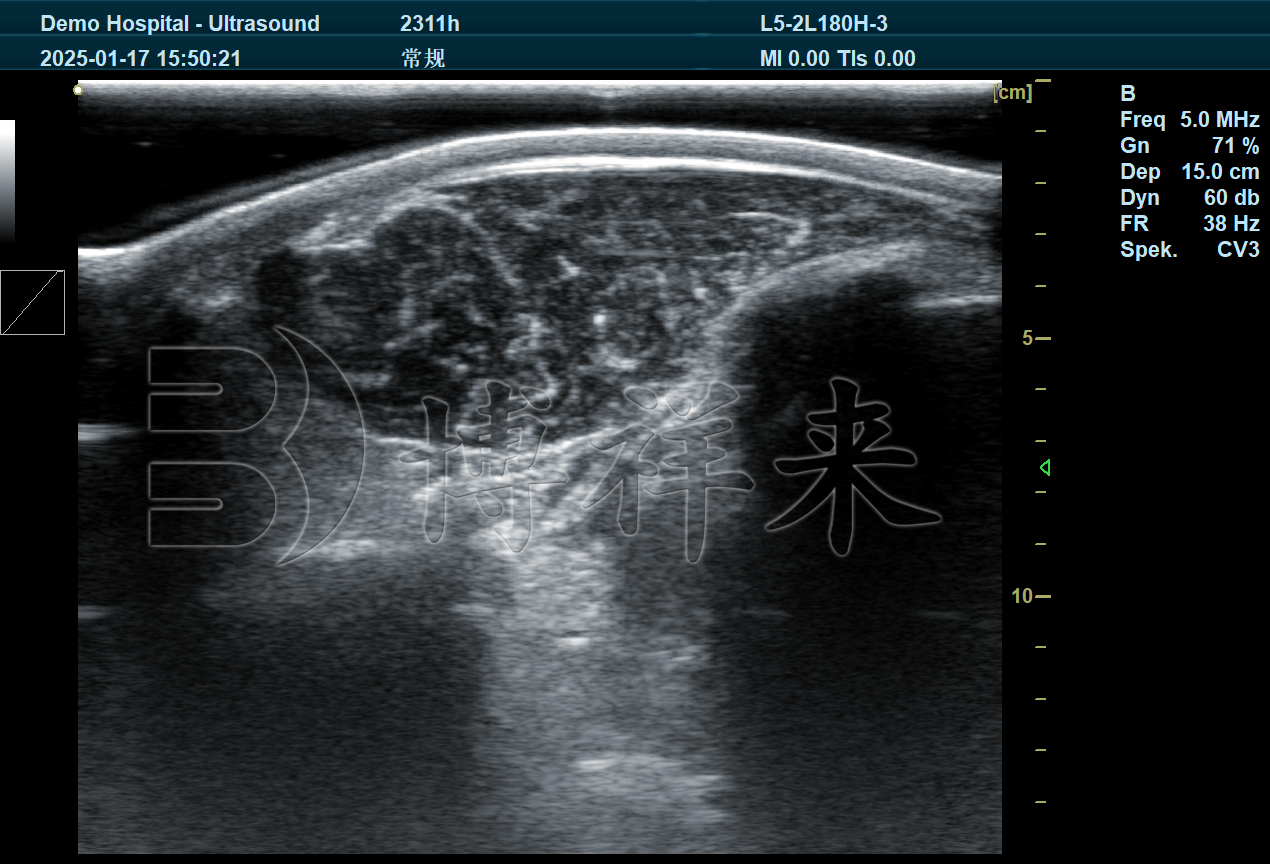 牛背膘眼肌视频-DB20 (1).jpg