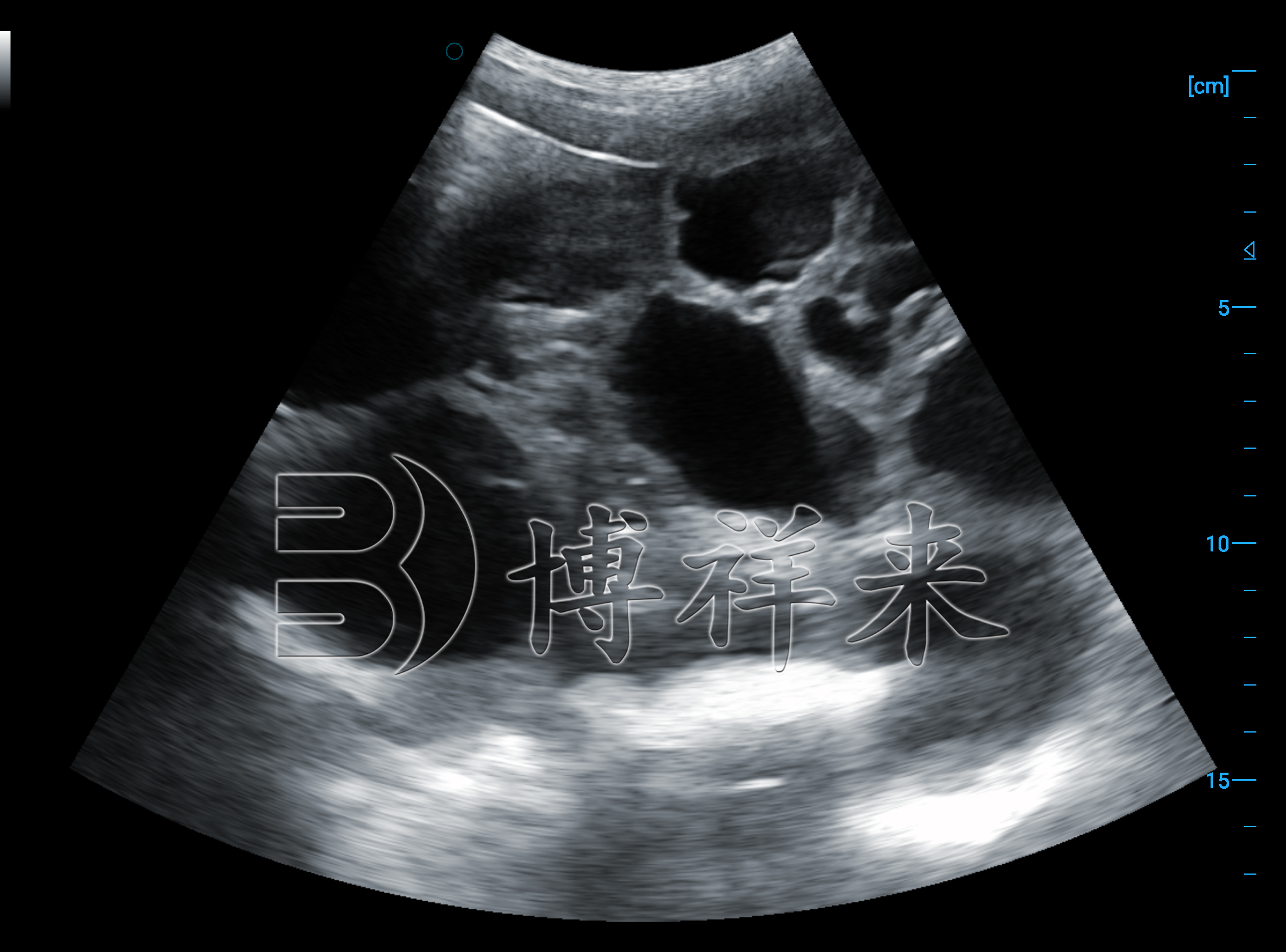 猪用B超机测孕超声图像 猪用B超机测孕超声图像