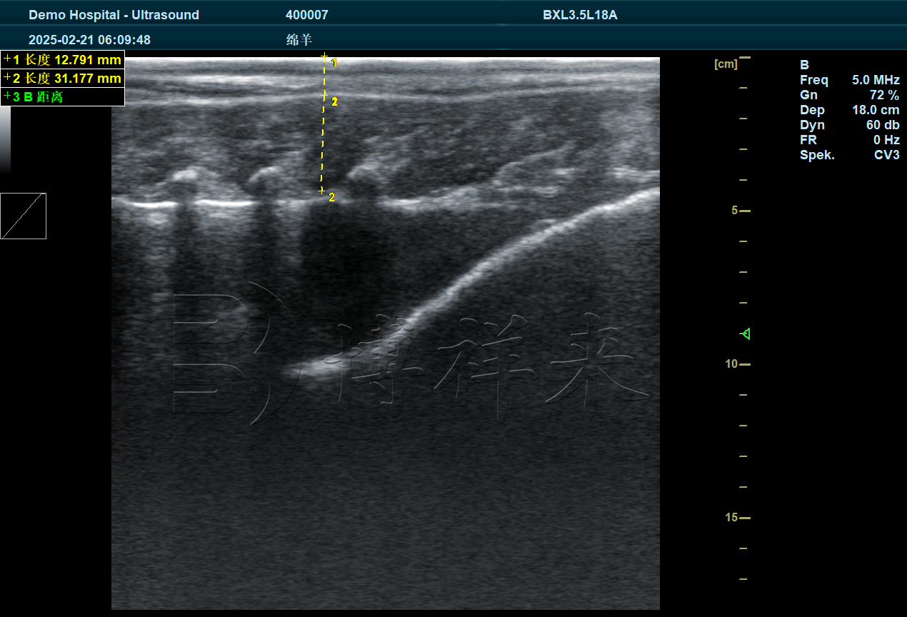 2025.02 赛诺羊场DZ20羊背膘眼肌 (7).png