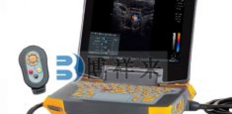 母牛OPU活体采卵仪辅助进行体外生产胚胎技术的优点